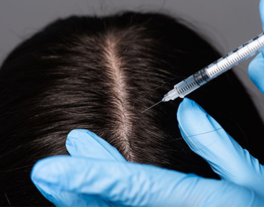 GFC Treatment